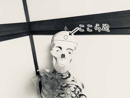 割れ目