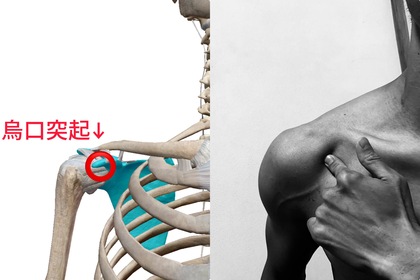 烏口突起がない…？？